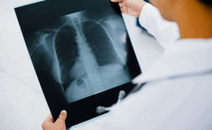 Imagen para el diagnóstico y la medicina nuclear